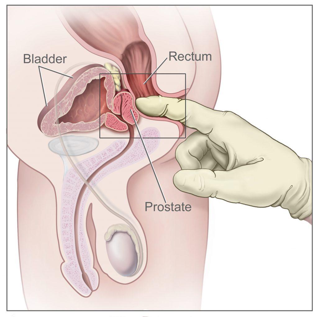 Prostate fluid