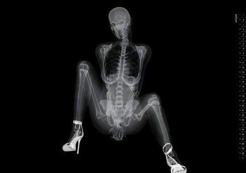 Fumble reccomend x ray