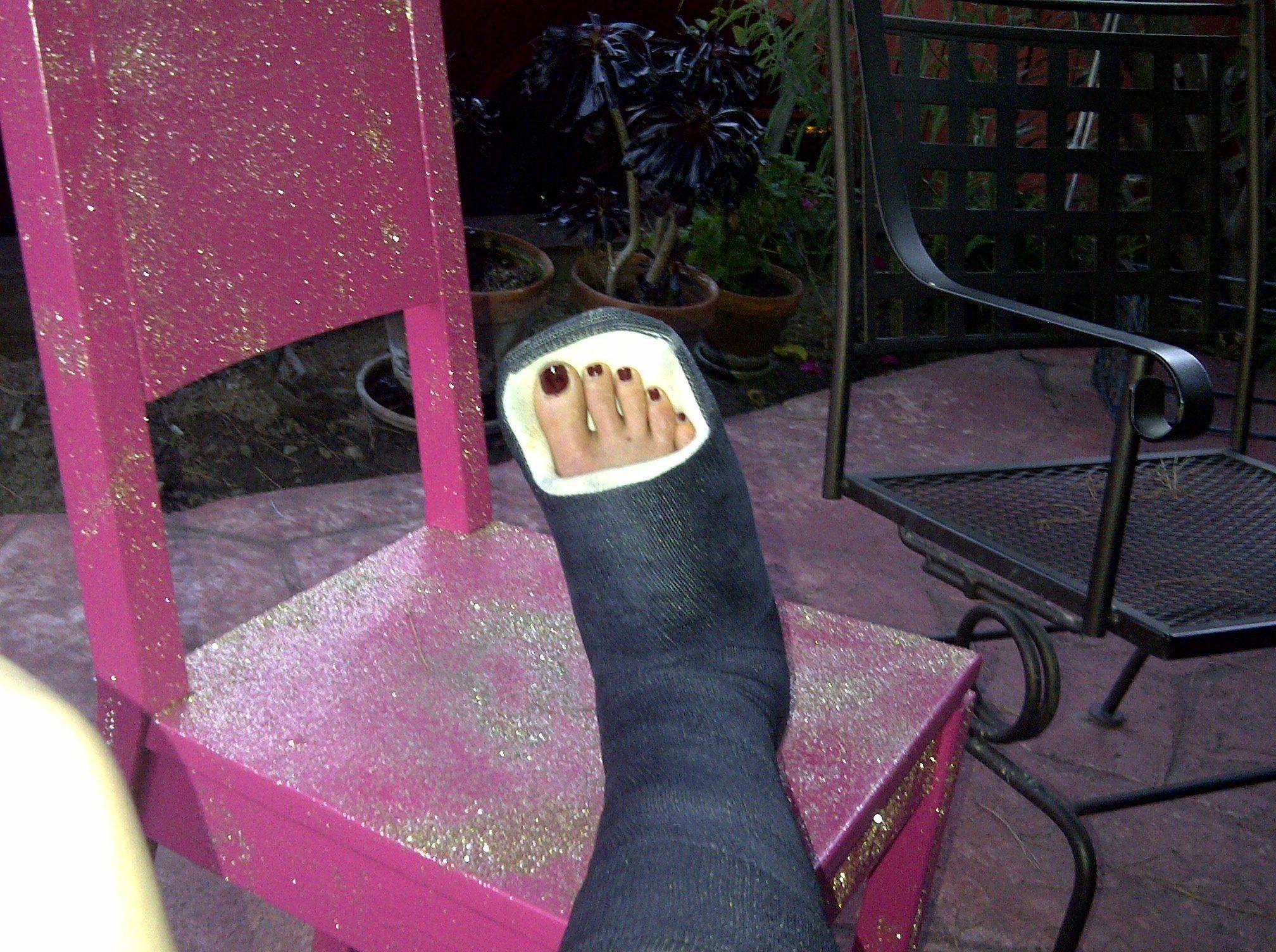 Broken ankle cast