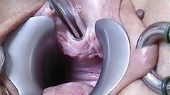 The M. recomended urethral play