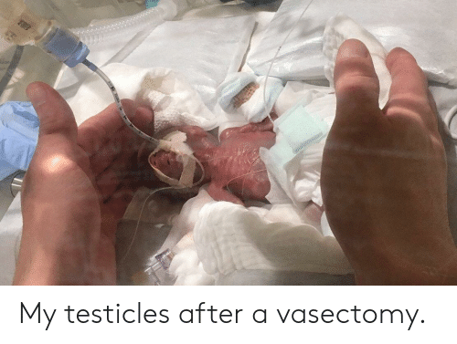 best of Up sperm built Vasectomy