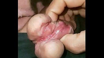 Oral sex with cut on penis