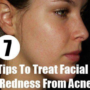 best of Natural Facial redness