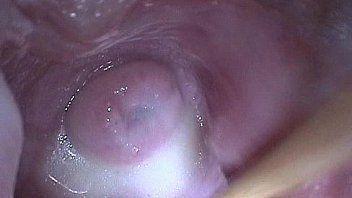 Cervix cock full labia stretched