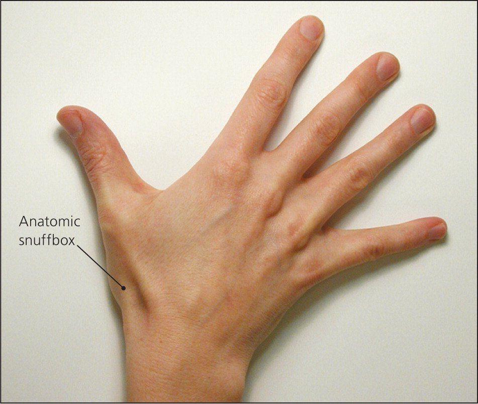 Fennel reccomend Cyst in ulnar styloid of thumb