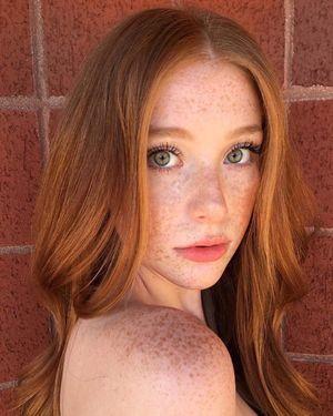 Henchman reccomend freckled brunette teen