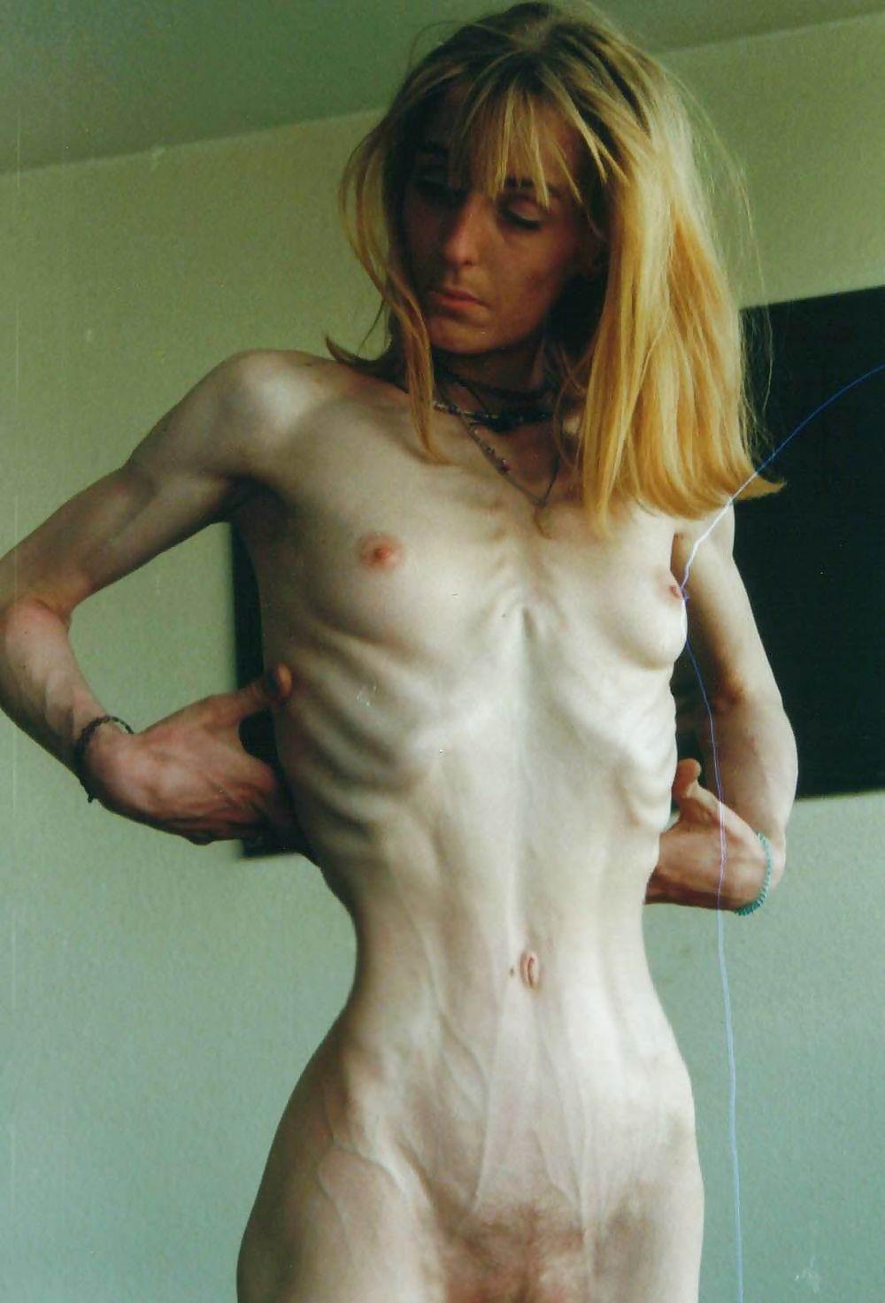 Claws reccomend anorexia nude