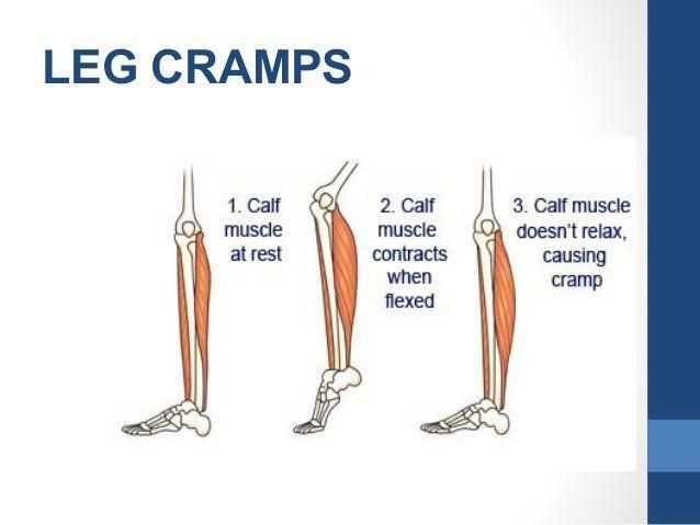 Engineer reccomend Leg cramp following orgasm