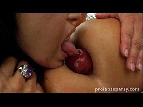Licking prolapse lesbian